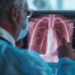 Tuberculosis en Risaralda: más casos, pero menos muertes.